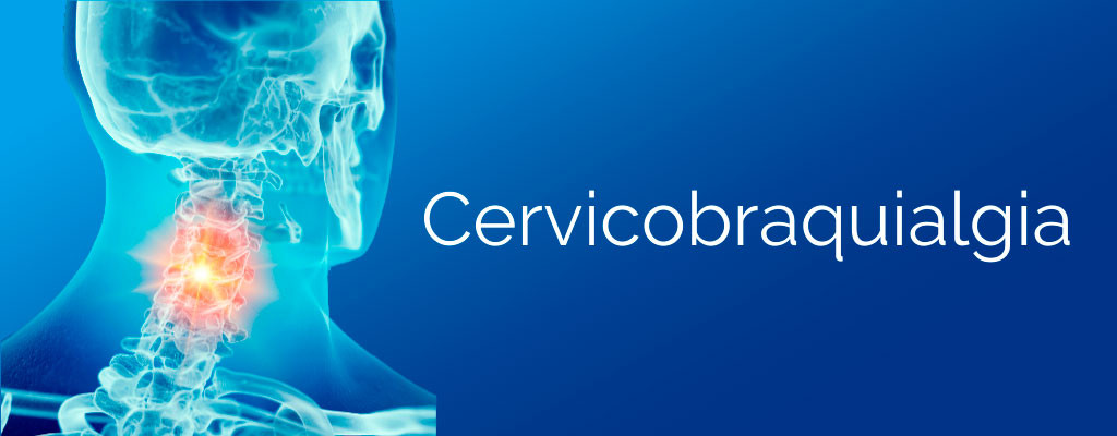 O que é cervicobraquialgia? Conheça causas e tratamentos!