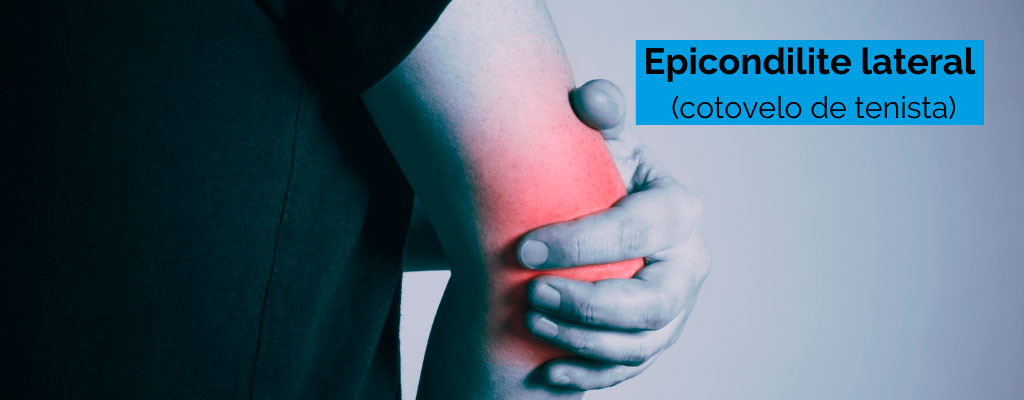 O que é epicondilite lateral (cotovelo de tenista): a principal causa de dor no cotovelo